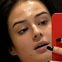 Lauraysergii Nagie