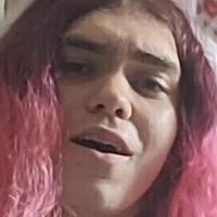 roseyccomplexion Nagie