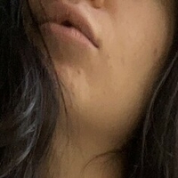 traversetina Nagie